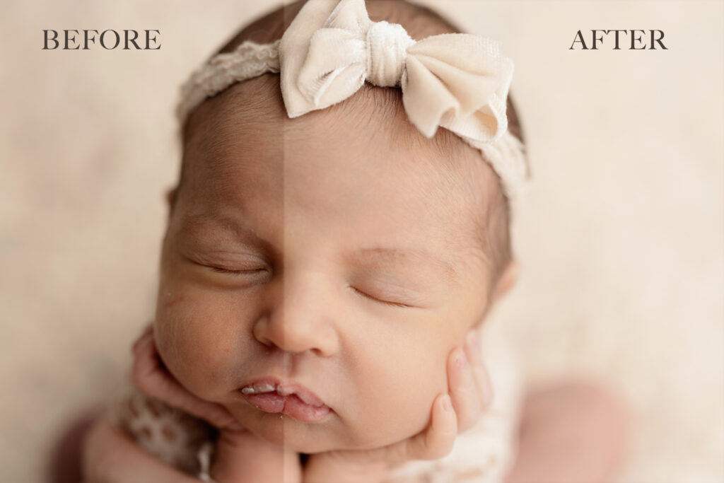 before and after